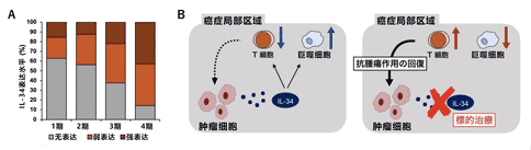 日本新研究指出IL-34與卵巢癌的進(jìn)展和復(fù)發(fā)有密切聯(lián)系！