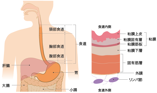 食道癌分期