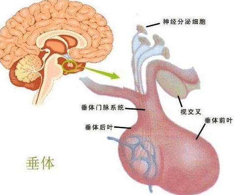 腦垂體瘤治療方法