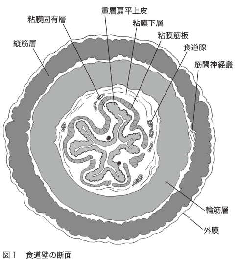 食道癌治療技術(shù)