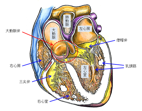 老人心臟瓣膜病治療