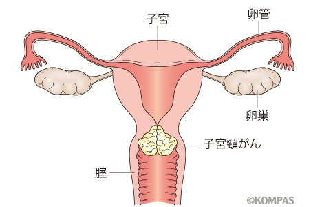 日本宮頸癌醫(yī)院