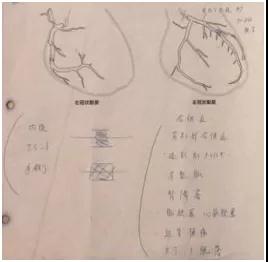 日本治療冠心病