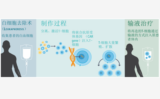 CAR-T治療新進(jìn)展