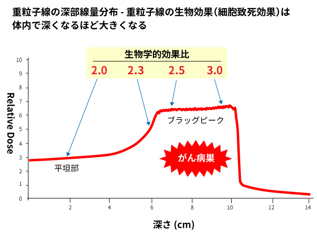 重離子治療骨肉瘤優(yōu)勢