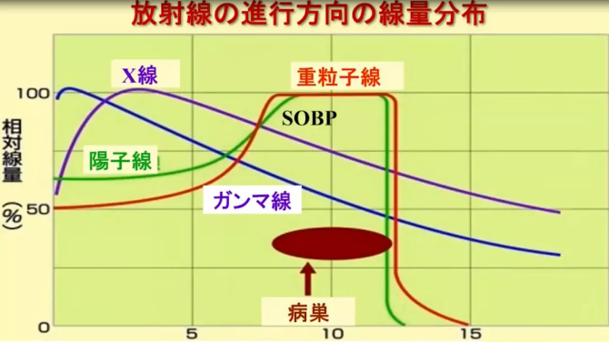 質(zhì)子重離子治療癌癥