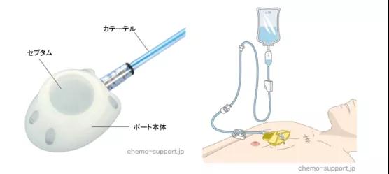 癌癥化療專家