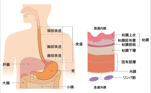 日本質(zhì)子治療食道癌