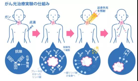 光免疫治療癌癥