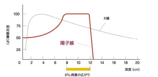 日本骨肉瘤質(zhì)子治療