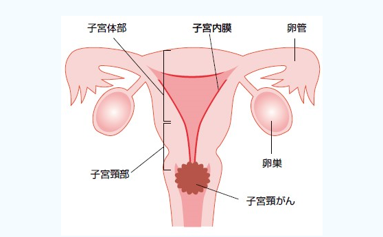 日本宮頸癌醫(yī)院排名